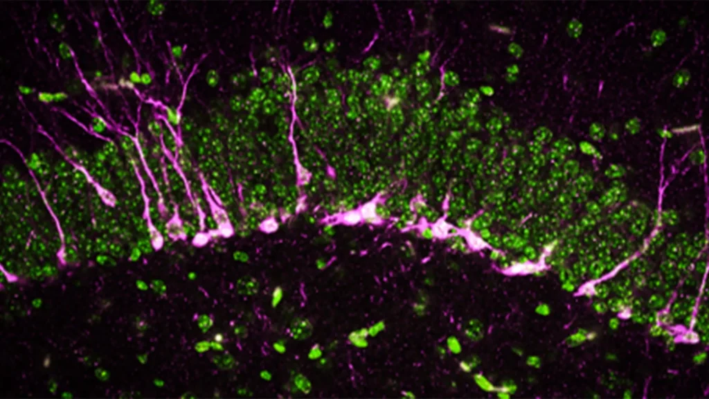 doublecortin stained newborn neurons and nuclear stain dapi.webp.webp